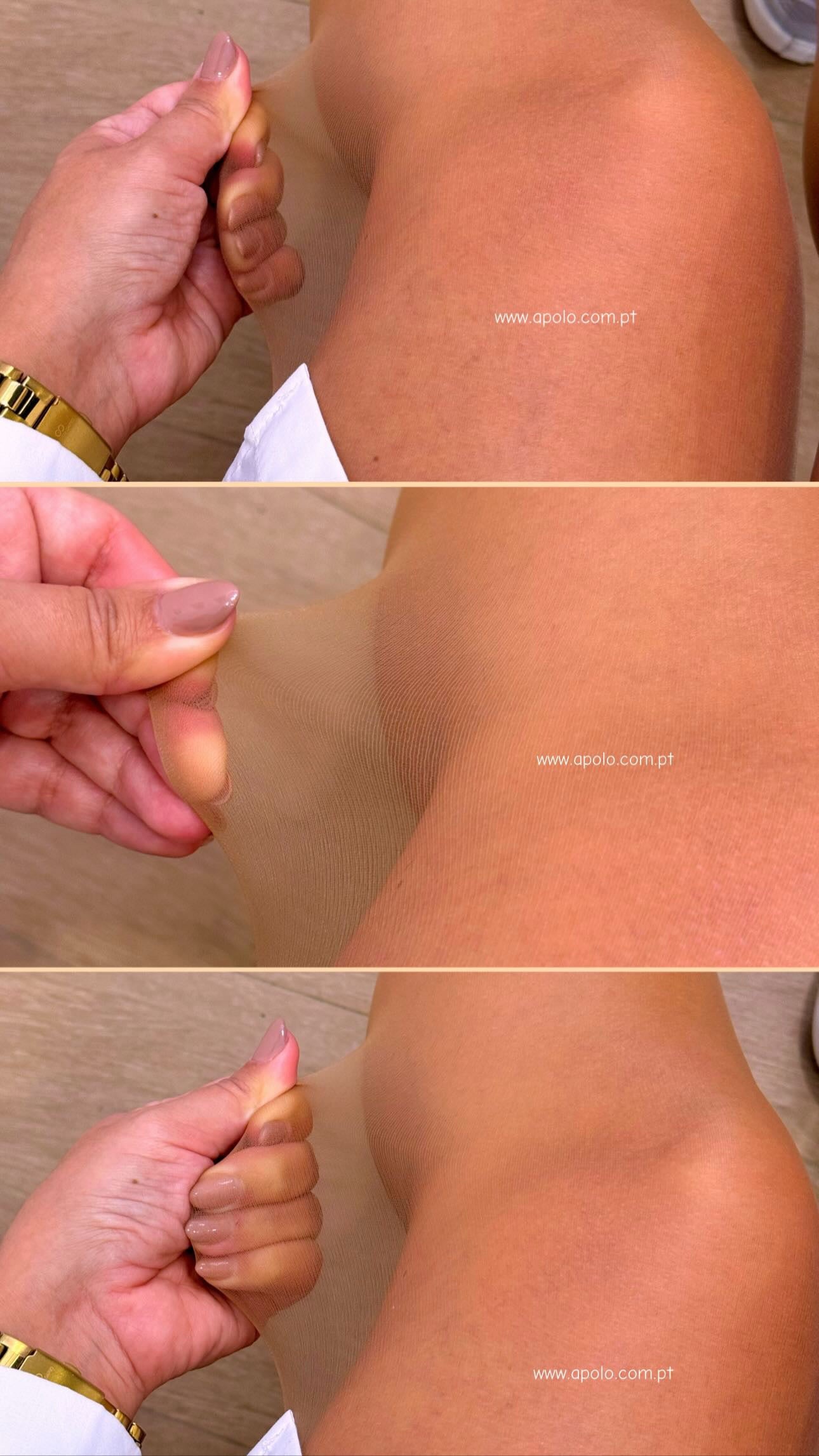 Meia-calça resistente efeito redutor abdômen | Bege escurinho • efeito pele morena